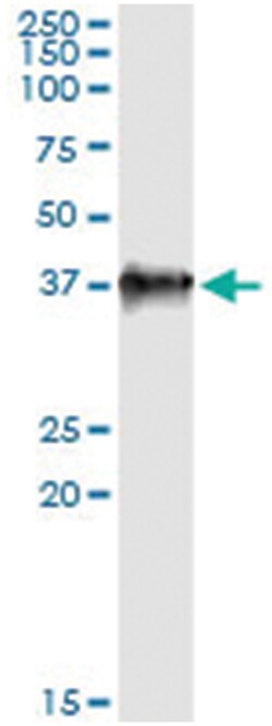 LZTFL1, Human, IP-WB Antibody Pair (PW2), Abnova&trade;