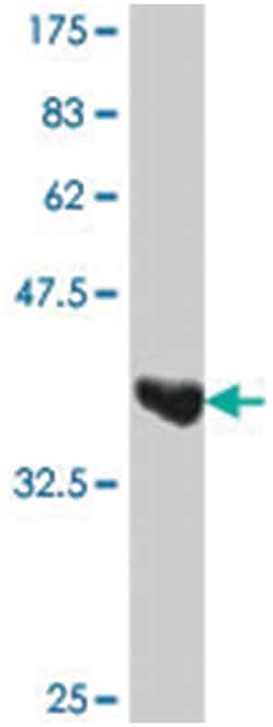 UGT1A9, Mouse, Polyclonal Antibody, Abnova 50&mu;L; Unlabeled:Antibodies,
