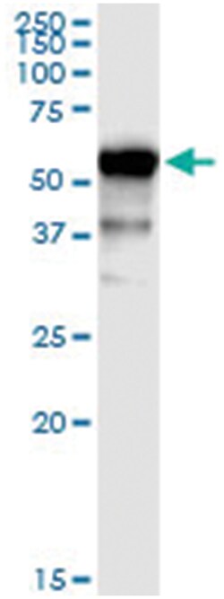 UGT1A9, Human, IP-WB Antibody Pair (PW1), Abnova&trade;