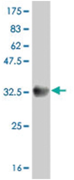 SLC6A20, Mouse, Polyclonal Antibody, Abnova 50&mu;L; Unlabeled:Antibodies,