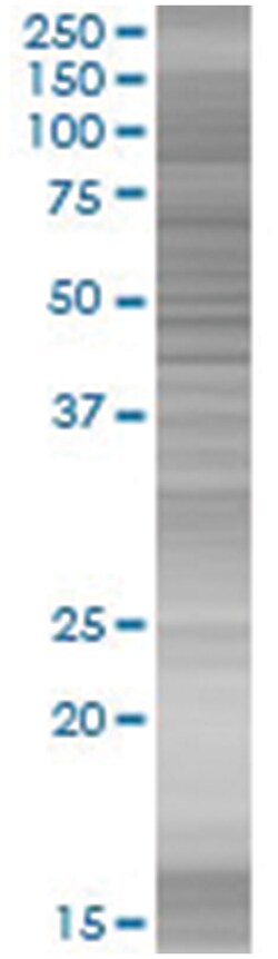 FEV 293T Cell Overexpression Lysate (Denatured), Abnova 100 &mu;L | Buy Online | Abnova | Fisher Scientific