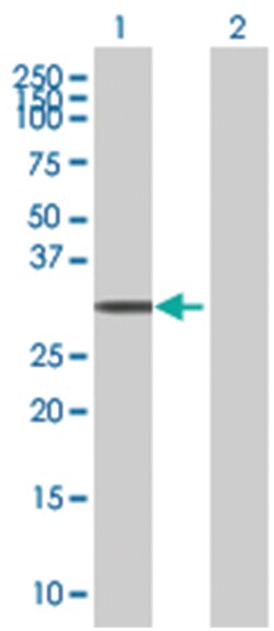 FEV 293T Cell Overexpression Lysate (Denatured), Abnova 100 &mu;L | Buy Online | Abnova | Fisher Scientific