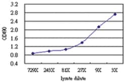 anti-KLHDC4 Matched Antibody Pair, Abnova™
