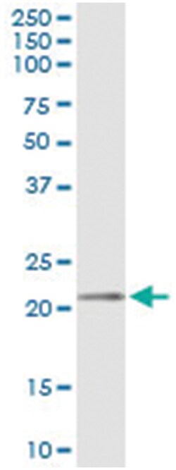 anti-MED18, Human, IP-WB Antibody Pair, Abnova&trade;
