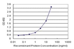 anti-ERCC6L Matched Antibody Pair, Abnova