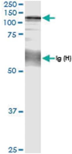 anti-CC2D1A, Human, IP-WB Antibody Pair, Abnova 1 Set:Antibodies, Monoclonal/Polyclonal