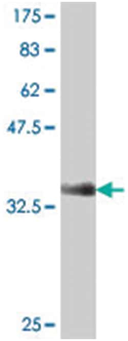 NCAPG2 (LUZP5), Mouse, Polyclonal Antibody, Abnova 50&mu;L; Unlabeled:Antibodies,