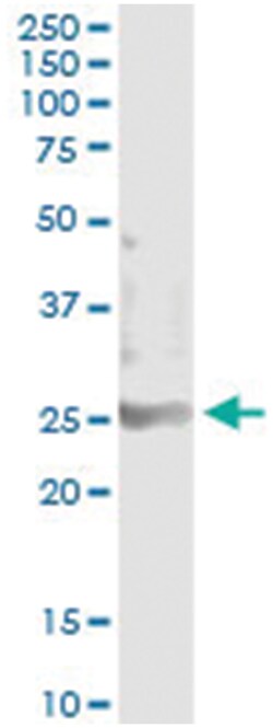 SOHLH2, Human, IP-WB Antibody Pair (PW2), Abnova&trade;