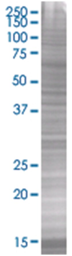 TXNL4B 293T Cell Overexpression Lysate 2 (Denatured), Abnova 100 &mu;L | Buy Online | Abnova | Fisher Scientific