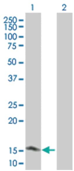 TXNL4B 293T Cell Overexpression Lysate 2 (Denatured), Abnova 100 &mu;L | Buy Online | Abnova | Fisher Scientific