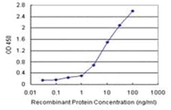 Abnova Corporation anti-TIPIN Matched Antibody Pair, Abnova