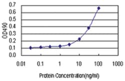 anti-PIH1D1 Matched Antibody Pair, Abnova&trade;
