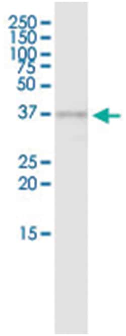 PIH1D1, Human, IP-WB Antibody Pair (PW3), Abnova&trade;