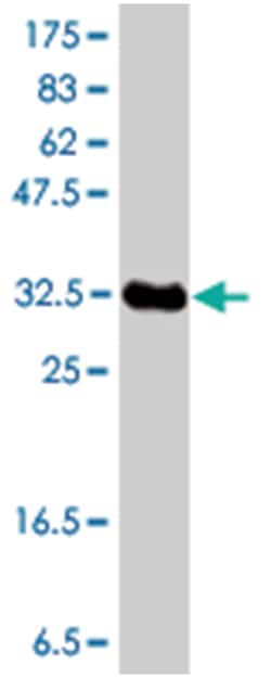 42430, Mouse, Polyclonal Antibody, Abnova 50 &mu;L | Buy Online | Abnova Corporation | Fisher Scientific