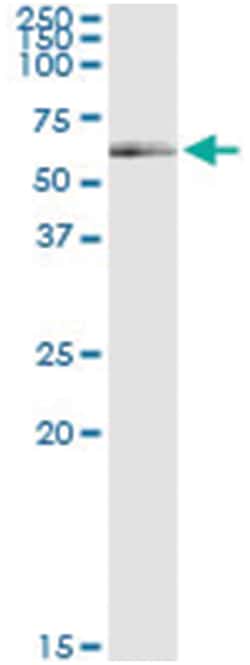 anti-ATG16L1, Human, IP-WB Antibody Pair, Abnova&trade;