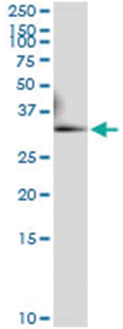 anti-RALGPS2, Human, IP-WB Antibody Pair, Abnova&trade;