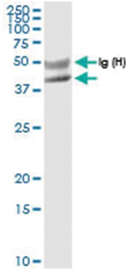 anti-FANCL, Human, IP-WB Antibody Pair, Abnova 1 Set:Antibodies, Monoclonal/Polyclonal