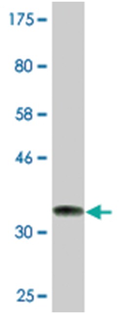 ARMC4, Mouse, Clone: 5F1, Abnova 200&mu;L; Unlabeled:Antibodies, Monoclonal