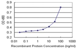anti-WDR79 Matched Antibody Pair, Abnova&trade;