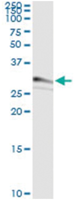 anti-CDCA8, Human, IP-WB Antibody Pair, Abnova&trade;