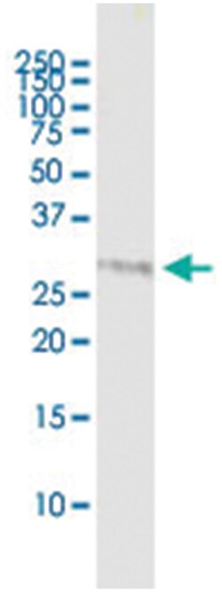 anti-THAP1, Human, IP-WB Antibody Pair, Abnova™