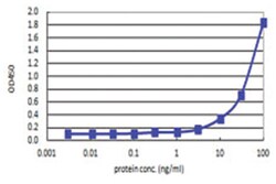 anti-PANK4, Human, Matched Antibody Pair, Abnova 1 Set | Buy Online | Abnova | Fisher Scientific