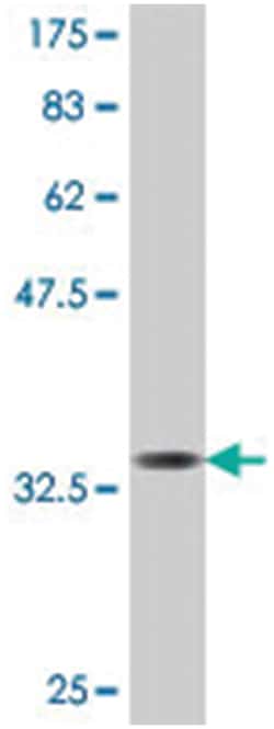 UBA6 (FLJ10808), Mouse, Polyclonal Antibody, Abnova 50 &mu;L | Buy Online | Abnova | Fisher Scientific