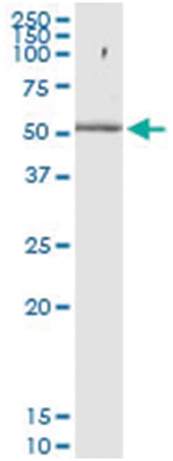 anti-PHF10, Human, IP-WB Antibody Pair, Abnova&trade;