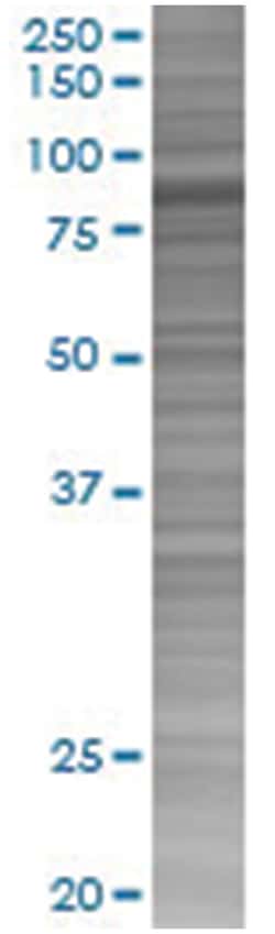 RHOT1 293T Cell Overexpression Lysate (Denatured), Abnova 100 &mu;L | Buy Online | Abnova | Fisher Scientific