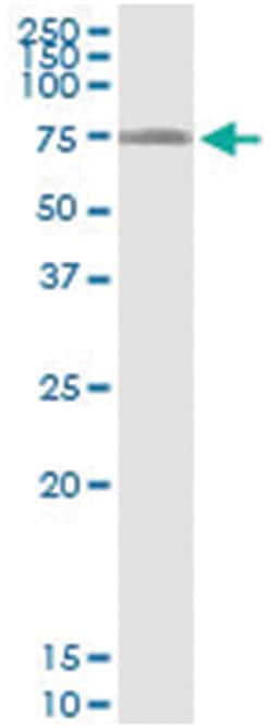 anti-LARP6, Human, IP-WB Antibody Pair, Abnova 1 Set:Antibodies, Monoclonal/Polyclonal