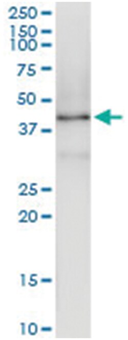 Abnova anti-FBXL8, Human, IP-WB Antibody Pair, Abnova™