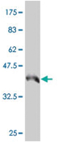 STK32B, Mouse, Polyclonal Antibody, Abnova 50&mu;L; Unlabeled:Antibodies,
