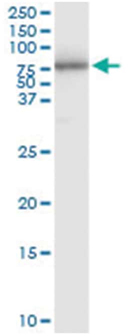 anti-PI4K2A, Human, IP-WB Antibody Pair, Abnova&trade;