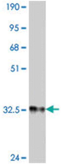 SNFT, Mouse, Polyclonal Antibody, Abnova 50&mu;L; Unlabeled:Antibodies,
