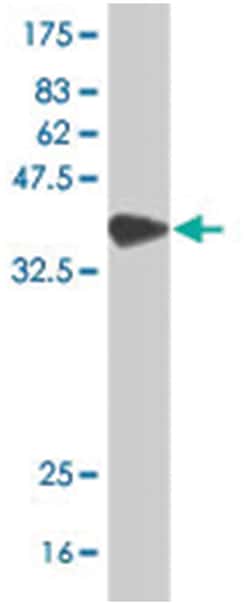 SAGE1, Mouse, Polyclonal Antibody, Abnova 50&mu;L; Unlabeled:Antibodies,