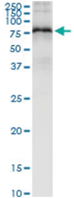 anti-SMPD3, Human, IP-WB Antibody Pair, Abnova&trade;