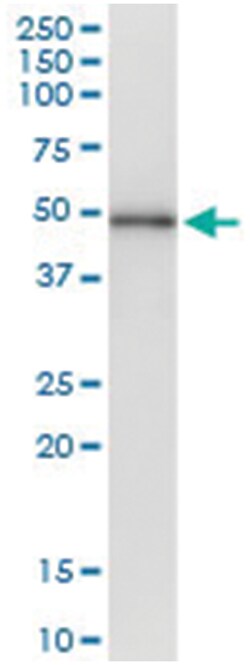anti-ELAC1, Human, IP-WB Antibody Pair, Abnova 1 Set:Antibodies, Monoclonal/Polyclonal