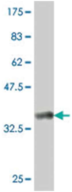 CDC42BPG, Mouse, Polyclonal Antibody, Abnova 50&mu;L; Unlabeled:Antibodies,