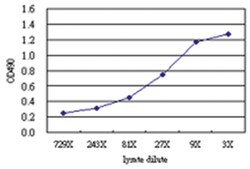 anti-CDKN2AIP Matched Antibody Pair, Abnova™