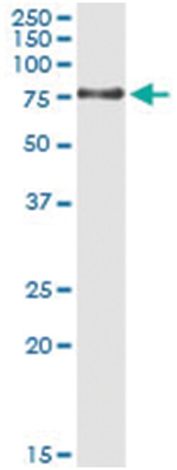 CDKN2AIP, Human, IP-WB Antibody Pair (PW1), Abnova™