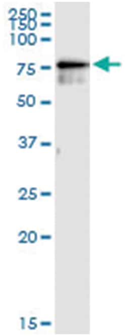 CDKN2AIP, Human, IP-WB Antibody Pair (PW2), Abnova&trade;