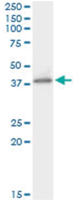 anti-HIF1AN, Human, IP-WB Antibody Pair, Abnova&trade;