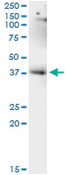 anti-LUC7L, Human, IP-WB Antibody Pair, Abnova™