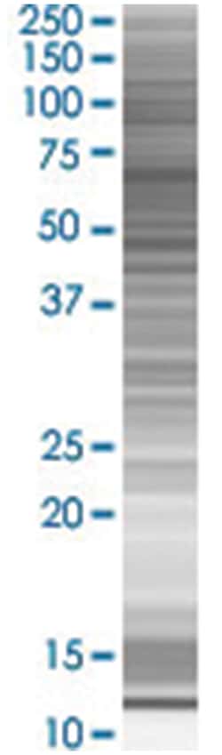 VAC14 293T Cell Overexpression Lysate (Denatured), Abnova 100 &mu;L | Buy Online | Abnova | Fisher Scientific