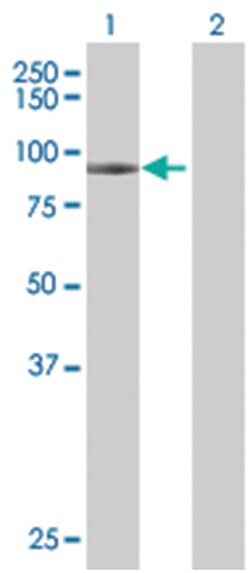 VAC14 293T Cell Overexpression Lysate (Denatured), Abnova 100 &mu;L | Buy Online | Abnova | Fisher Scientific