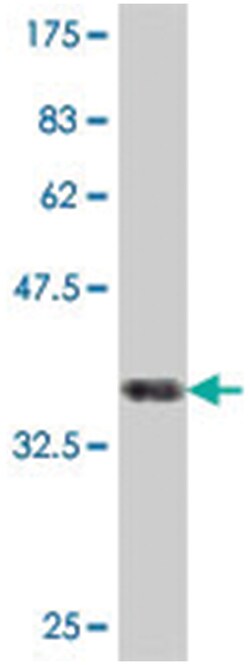 VPS35, Mouse, Polyclonal Antibody, Abnova 50 &mu;L | Buy Online | Abnova Corporation | Fisher Scientific
