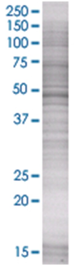 MULK 293T Cell Overexpression Lysate (Denatured), Abnova 100&mu;L 