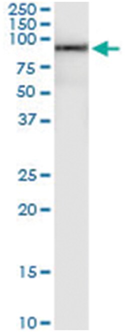 anti-TDP1, Human, IP-WB Antibody Pair, Abnova™