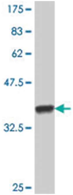 HR, Mouse, Polyclonal Antibody, Abnova 50&mu;L; Unlabeled:Antibodies, Polyclonal