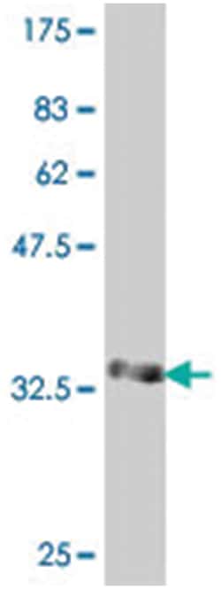 ST6GALNAC1, Mouse, Polyclonal Antibody, Abnova 50 &mu;L | Buy Online | Abnova Corporation | Fisher Scientific